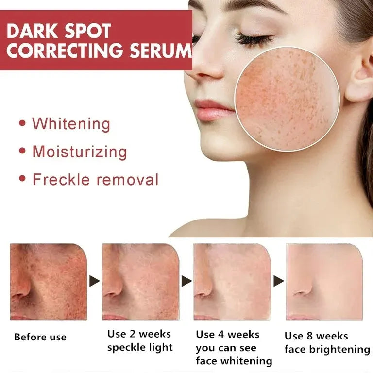 Anua Niacinamide 10% + Txa 4% Dark Spot Correcting Serum