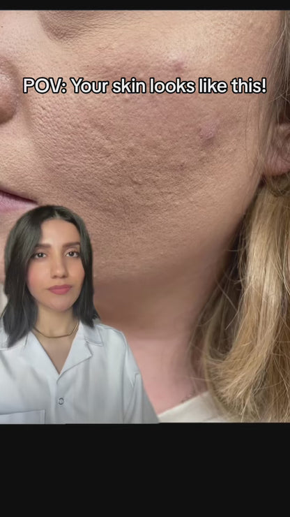 Cerave Resurfacing Retinol Serum