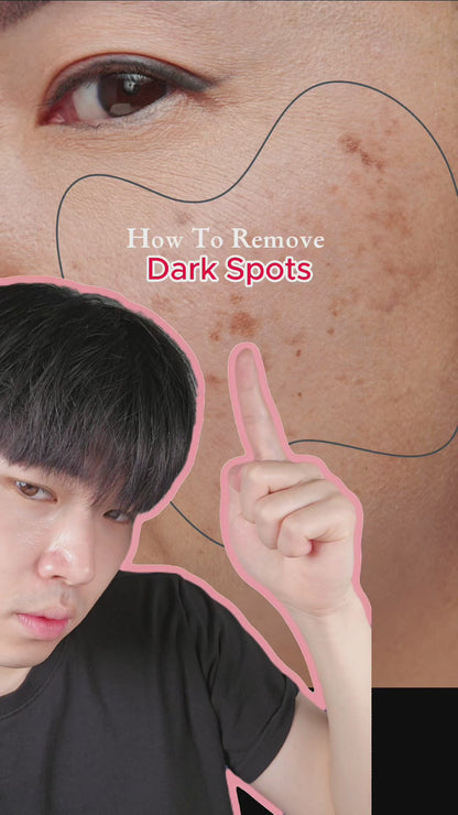 Anua Niacinamide 10% + Txa 4% Dark Spot Correcting Serum