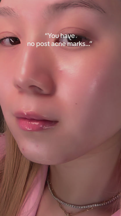 Anua Niacinamide 10% + Txa 4% Dark Spot Correcting Serum