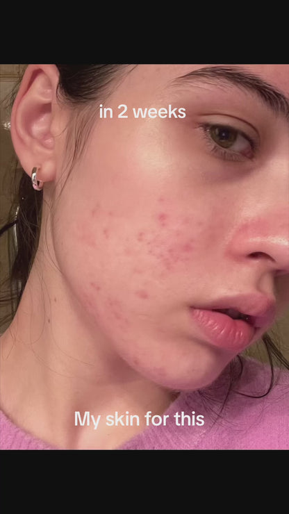 Anua Niacinamide 10% + Txa 4% Dark Spot Correcting Serum
