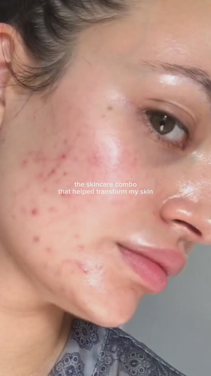 Cosrx the Vitamin C 23 Serum