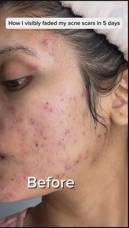 Anua Niacinamide 10% + Txa 4% Dark Spot Correcting Serum