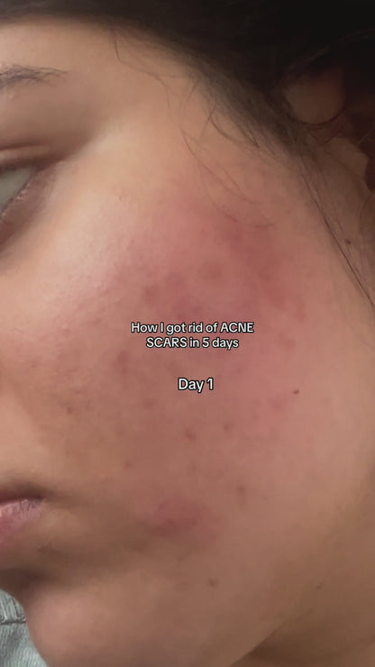 Anua Niacinamide 10% + Txa 4% Dark Spot Correcting Serum